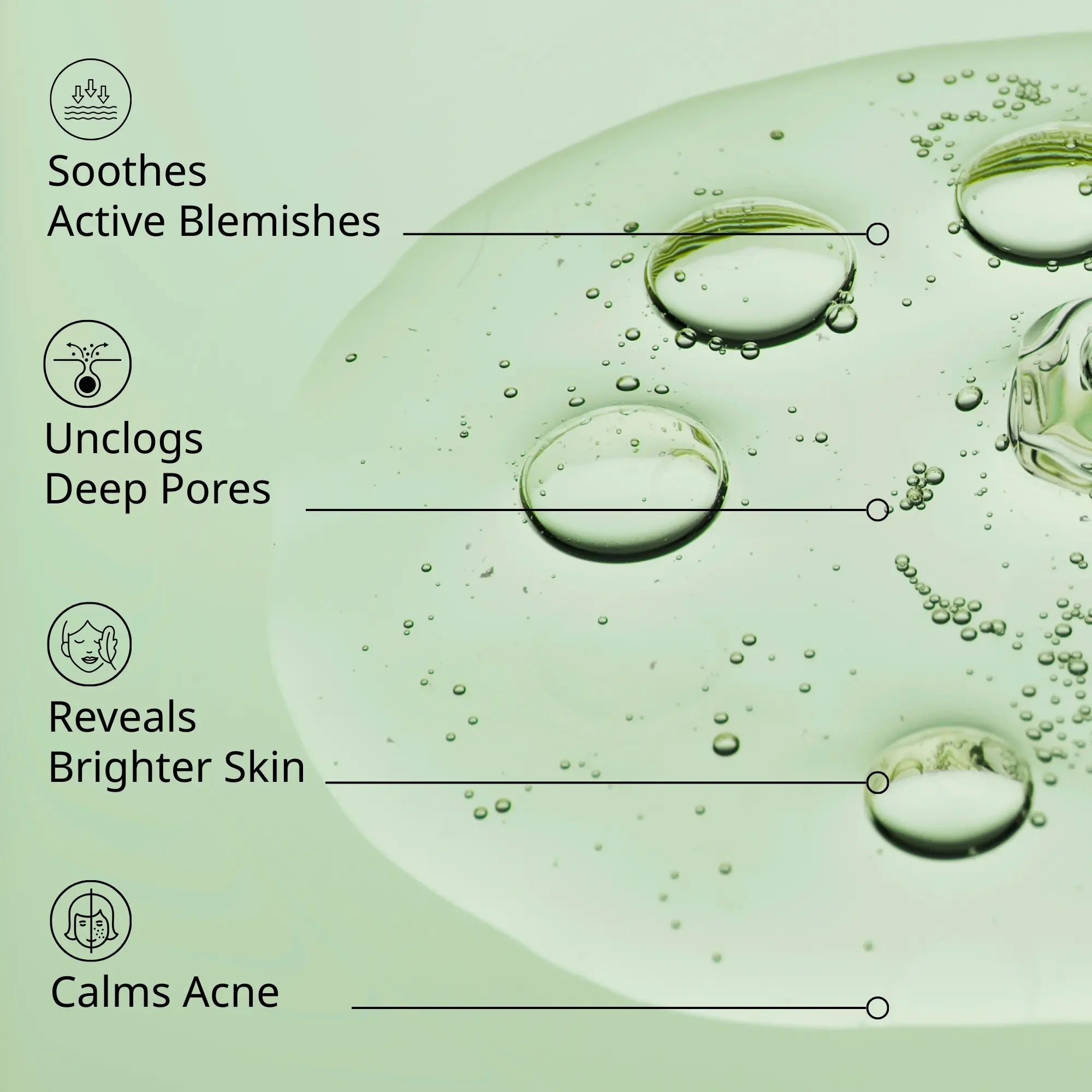 Acne Serum Benefits, soothes active blemishes, unclogs deep pores, calms acne, reveals brighter skin, gentle serum concentrate, sebum control solution